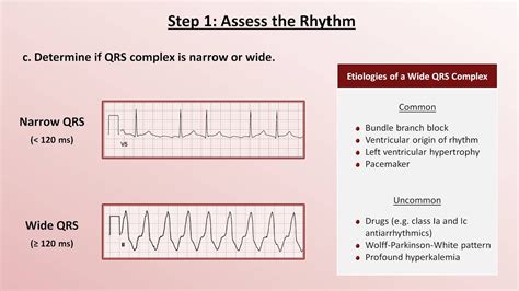 validity of ecg result|How to interpret the ECG: A systematic approach.